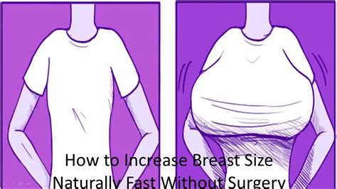 breast expansion real life|“My Breasts Grew 4 Sizes in 8 Months”: A Story of Gigantomastia